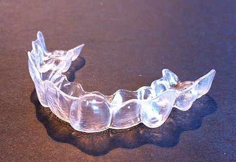 An Invisalign aligner