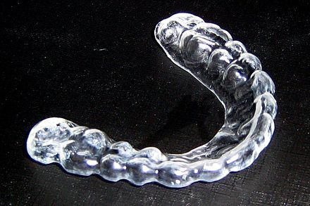 A type of Dental Mouthguard